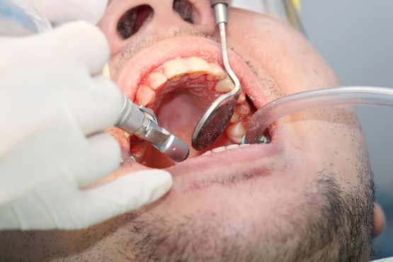 Kirurgi - Tandklinikken Brogade